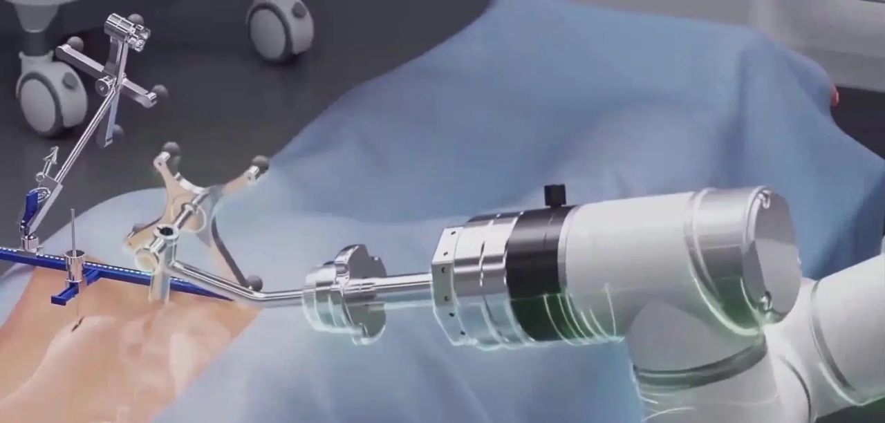 VR与AI在医疗领域的应用