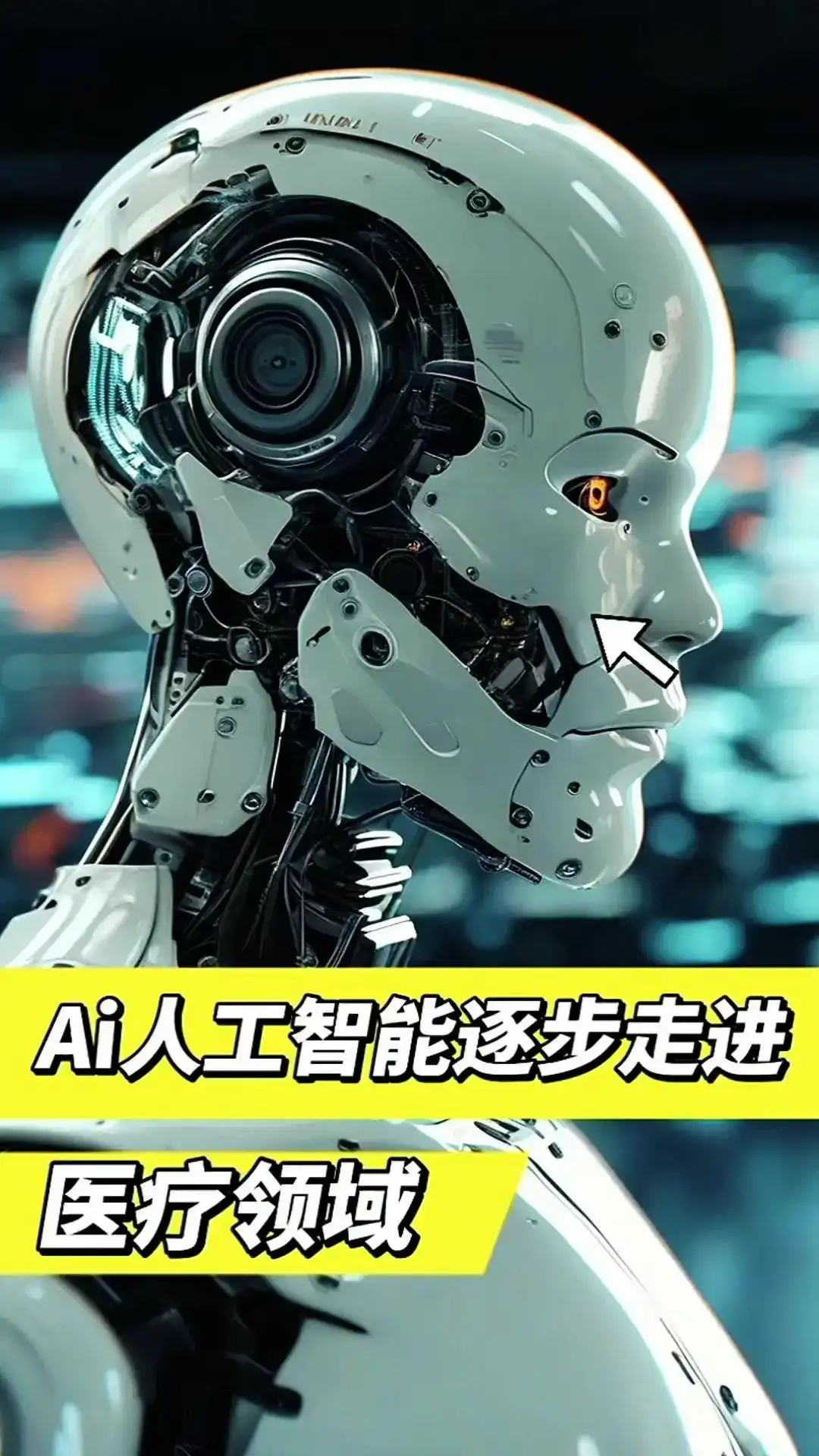 医疗领域新引擎：人工智能驱动变革