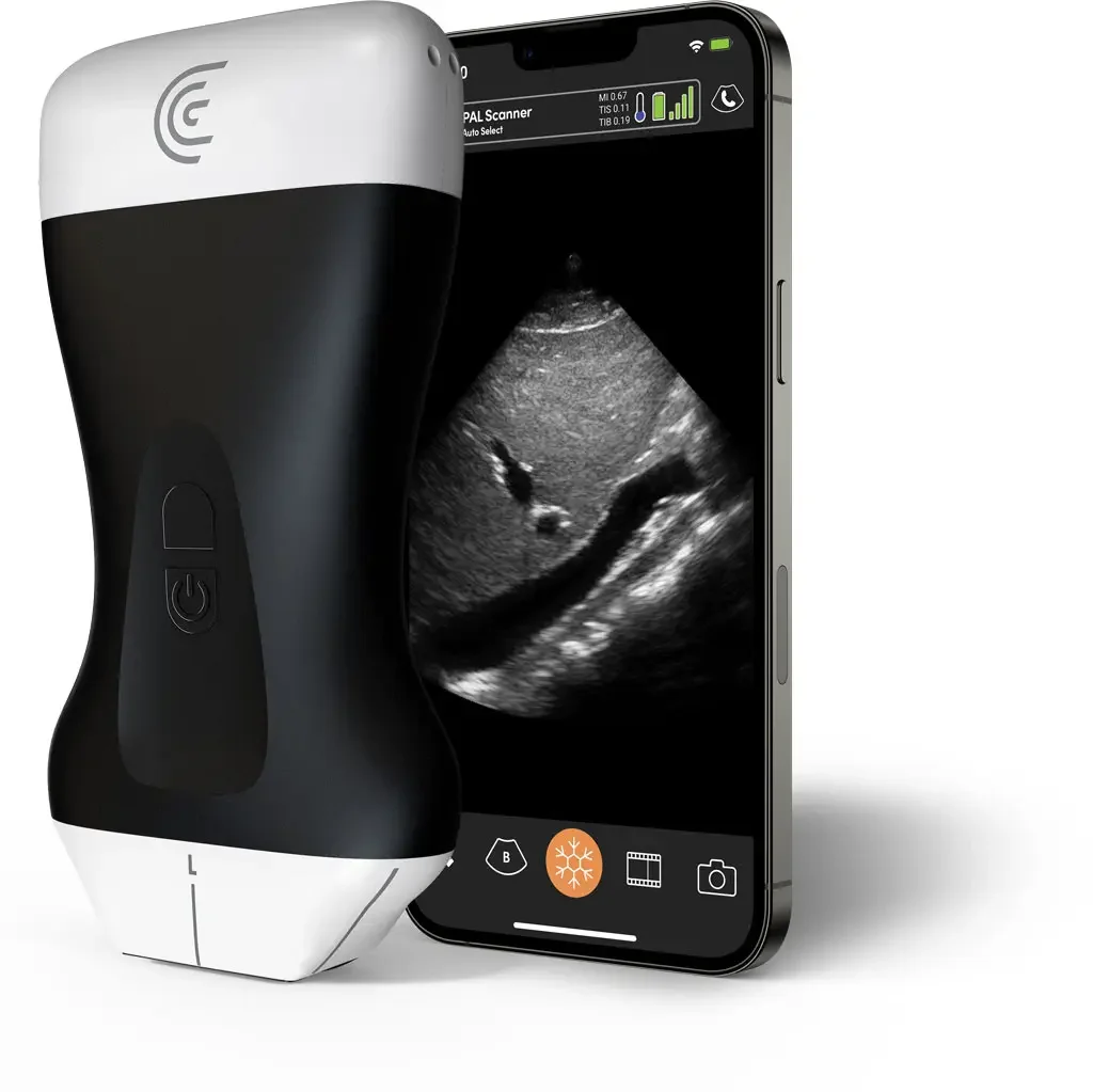 掌上超声的 “超级大脑”！端侧 AI vs 云侧